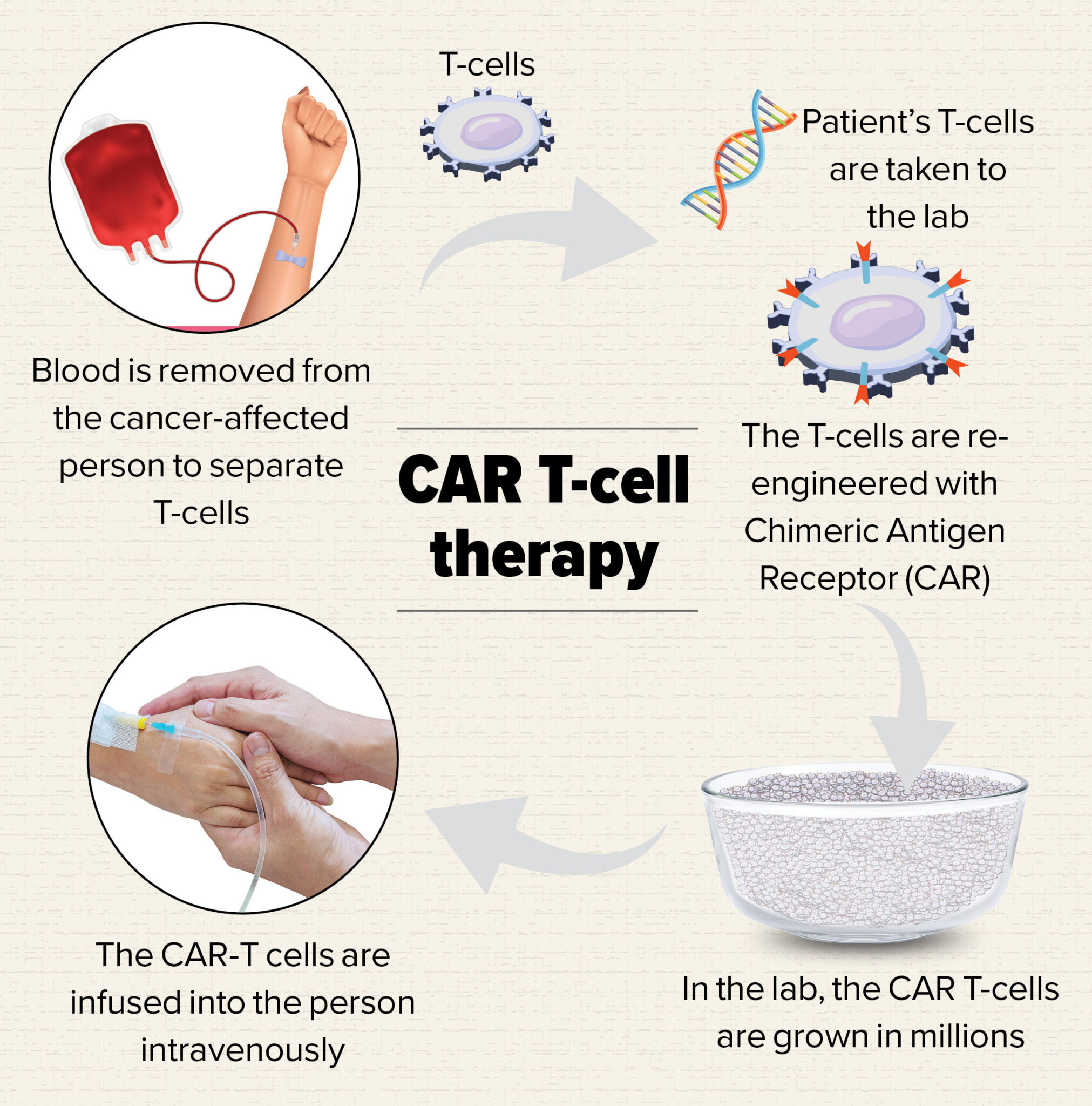 CAR T-cell therapy: : Fight cancer - Happiest Health