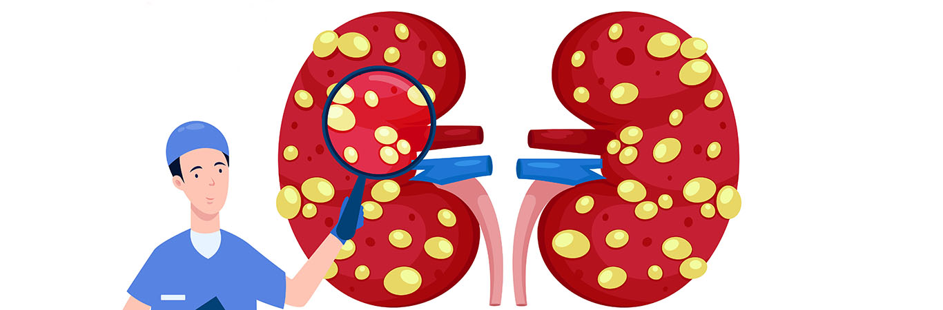 dos-and-don-ts-of-polycystic-kidney-disease-happiest-health