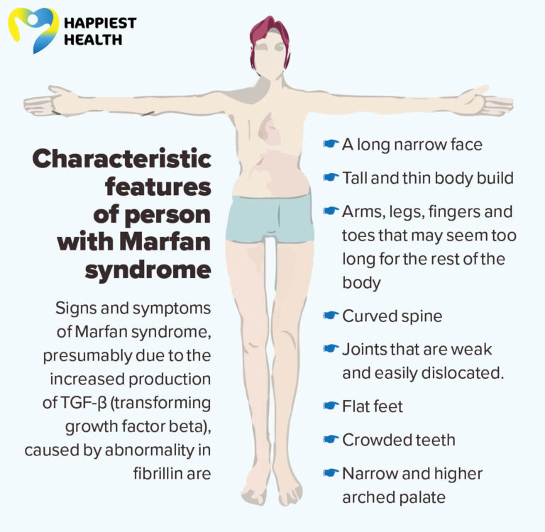 Marfan syndrome: Cause and Diagnosis | Happiest Health