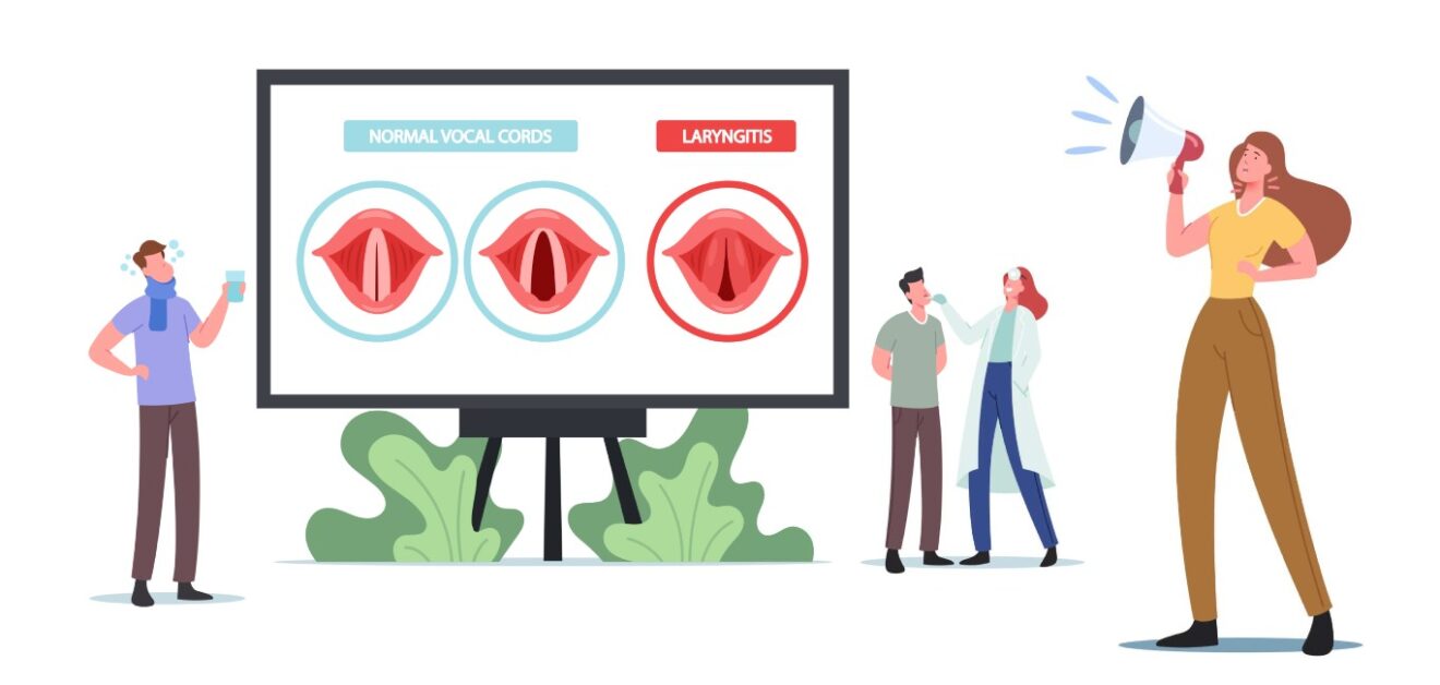 The hoarse truth All you need to know about laryngitis