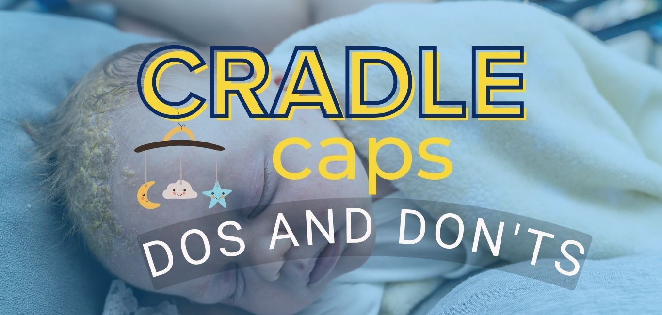 Cradle cap How to manage dry scalp in babies