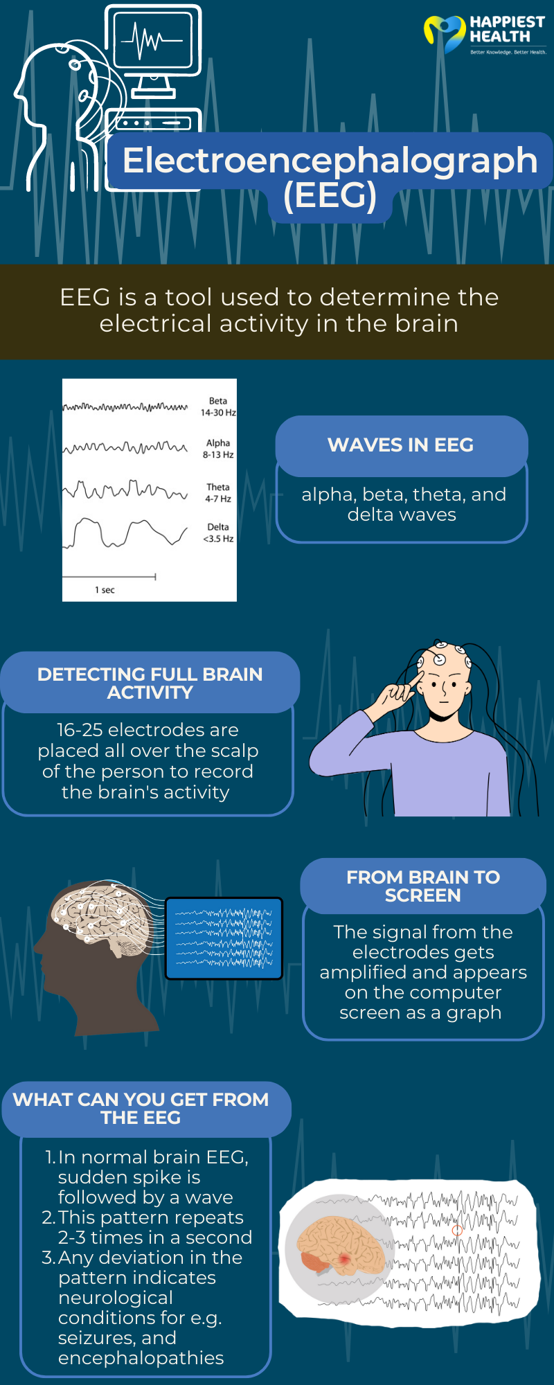 All you need to know about the EEG - Happiest Health